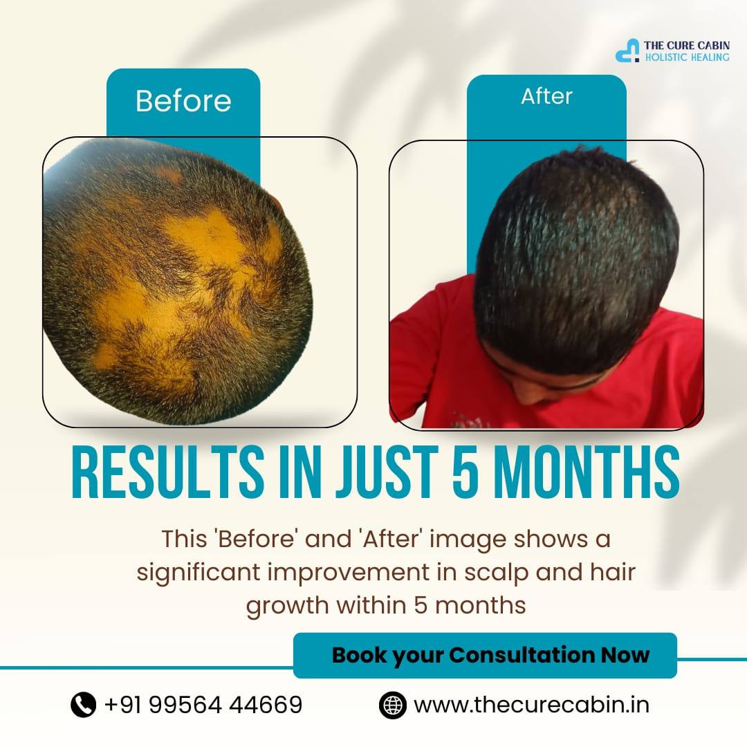 Before and after patient result